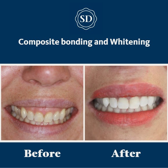 Shiphay Dental and Torbay Implant Centre