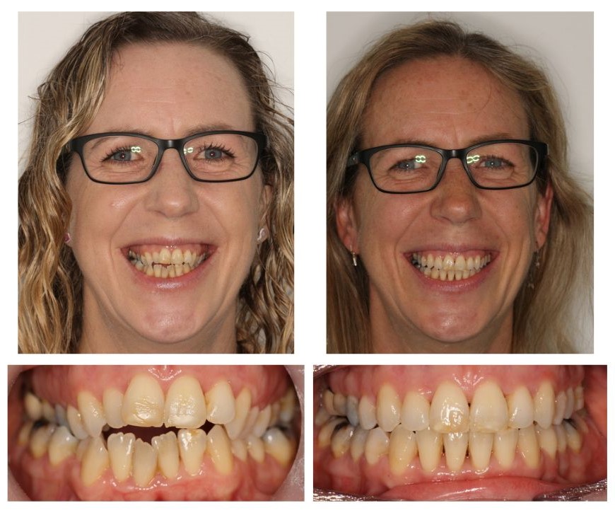 Bupa Dental Care Winchester