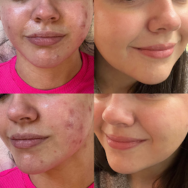 DK MED SPA /Microblading & Academy