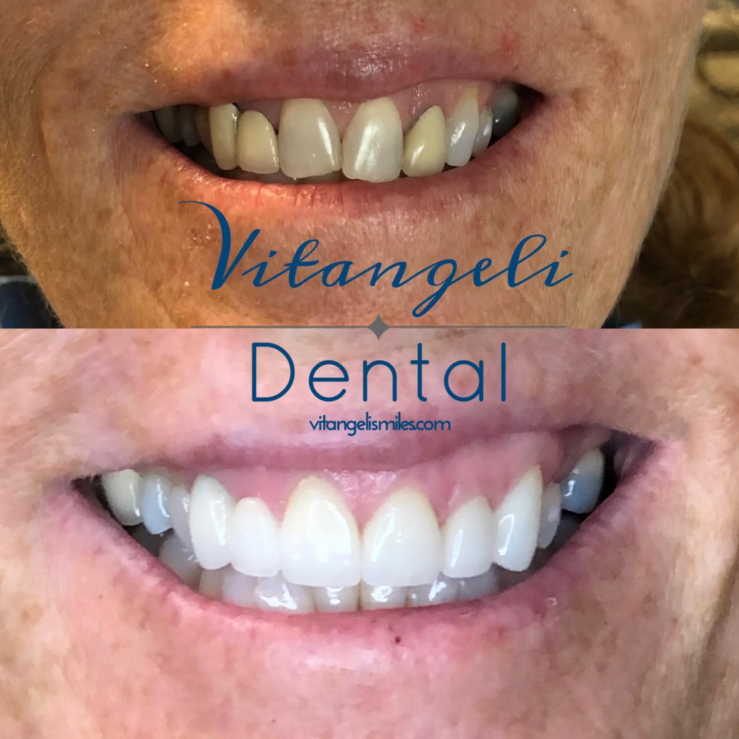 Vitangeli Dental 320 Union Blvd, Englewood Ohio 45322