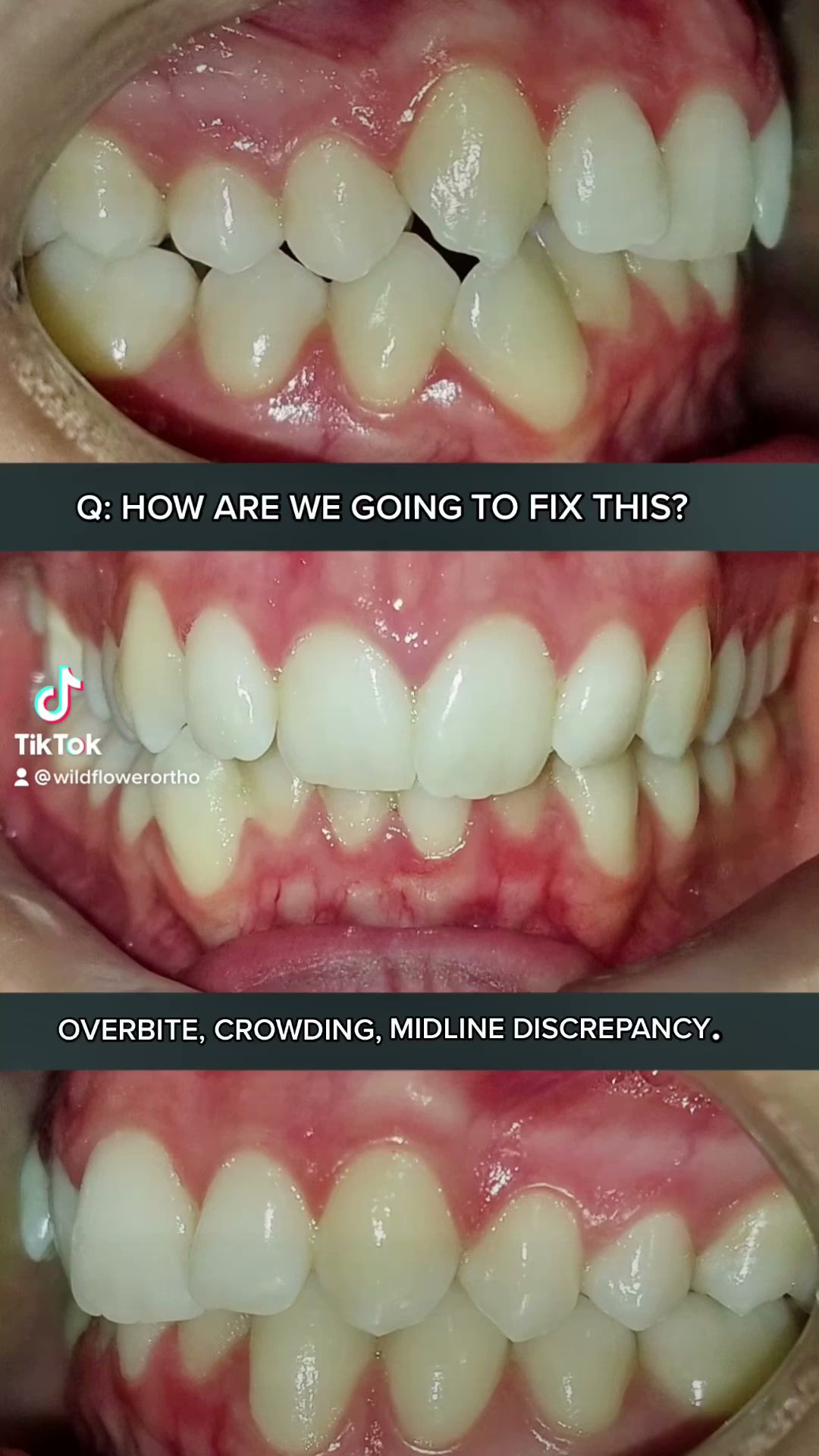 Wildflower Orthodontics 305 N Heatherwilde Blvd #420, Pflugerville Texas 78660